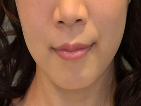 素人娘の全裸図鑑26　今時の女の子12名が恥らいながら脱衣していく様子をじっくり撮影した、変態紳士のためのヘアヌードコレクション　サンプル画像13